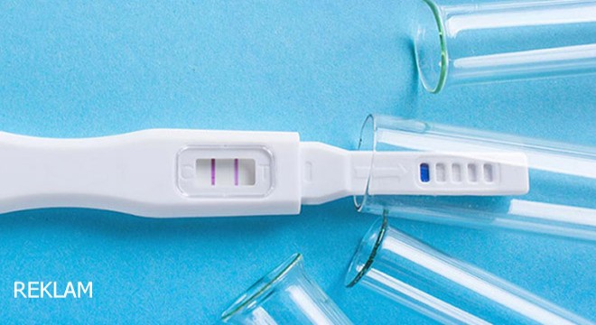 Tüp Bebek Tedavisi Hakkında Sıkça Sorulan Sorular