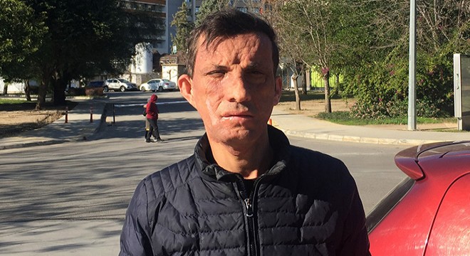 Türkiye'nin ilk yüz nakillisi Uğur Acar: Tek isteğim evlenmek