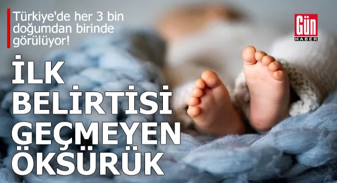 Türkiye de her 3 bin doğumdan birinde görülüyor!