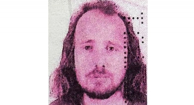 Türkiye ye saç ekimi için gelen İngiliz hayatını kaybetti