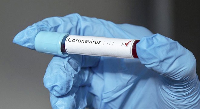 Ukrayna da ilk koronavirüs vakası tespit edildi