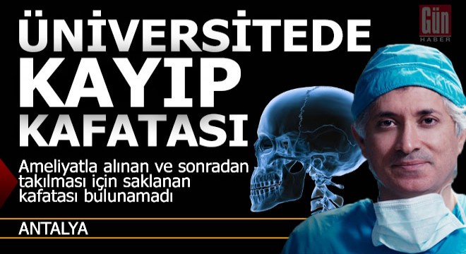 Üniversitede kayıp kafatası