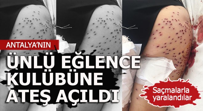 Ünlü gece kulübüne ateş açıldı müşteriler yaralandı