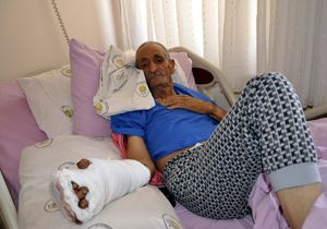77 Yaşındaki çiftçinin kopan eli yerinde dikildi