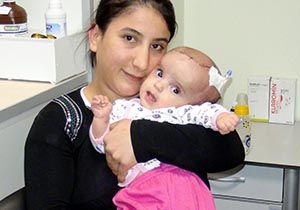 Üç aylık bebeğe beyin ameliyatı