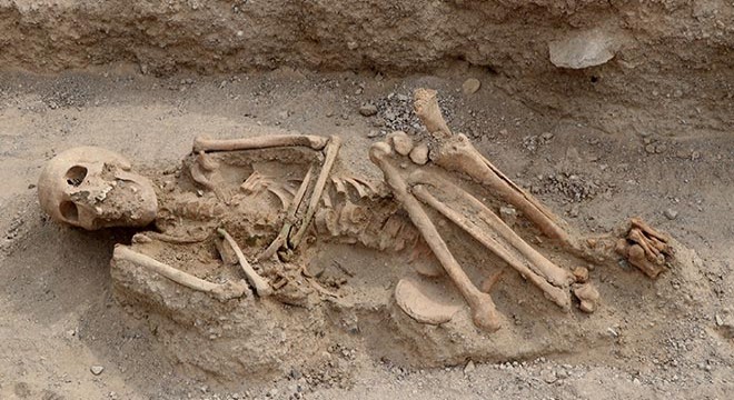 Urartular'a ait iskeletlerde çürük diş çıkmadı