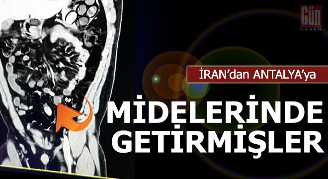 İran'dan Antalya'ya midelerinde getirmişler