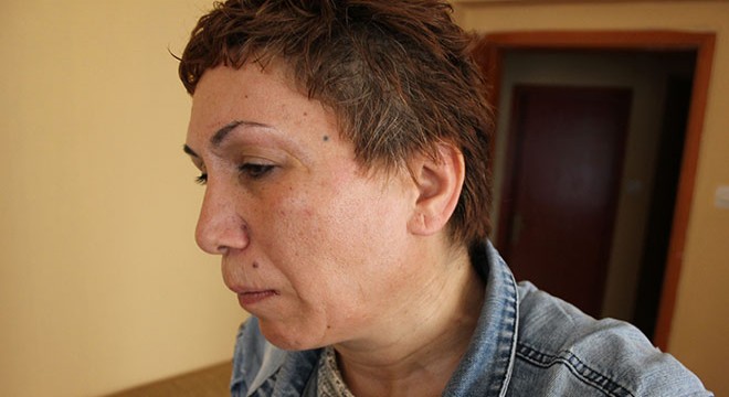 Uzaklaştırma kararı aldırdığı eski sevgilisi dövdü