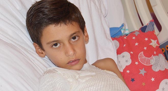 Üzerine kolonya döktüğü ikizini yaktı