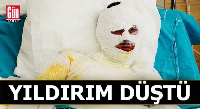 Üzerine yıldırım düşen çoban ağır yaralandı