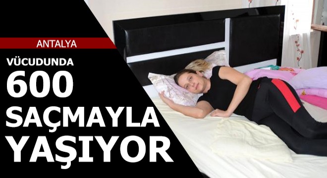 Vücudunda 600 saçmayla yaşıyor