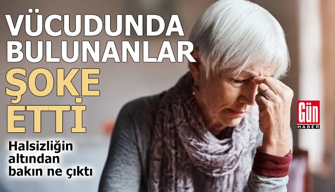 Vücudunda bulunanlar şoke etti! Halsizliğin altından bakın ne çıktı