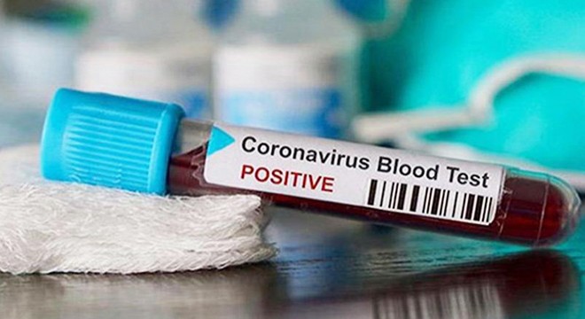 Yargıtay'dan 'koronavirüs' açıklaması