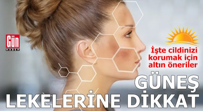 Yazın güneş lekelerine dikkat!