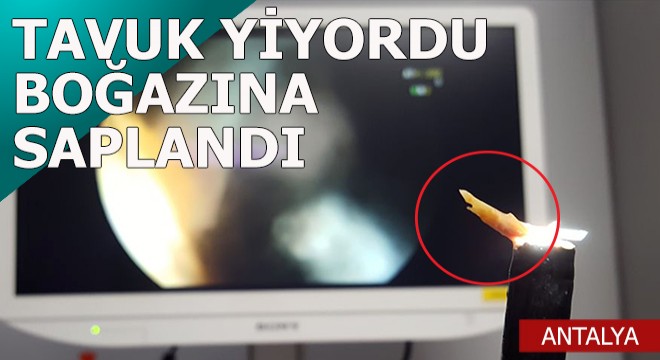 Yediği tavuğun boğazına saplanan kemiği operasyonla çıkarıldı