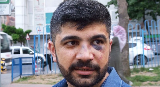 Yol verme tartışmasında feci şekilde dövüldü