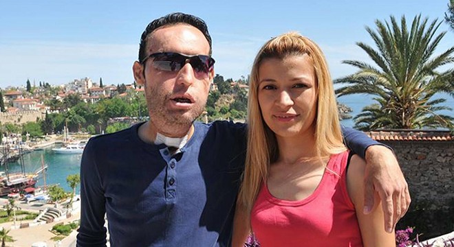 Yüz nakilli Recep Sert ile eşi Esma Sert'ten ayrılık kararı