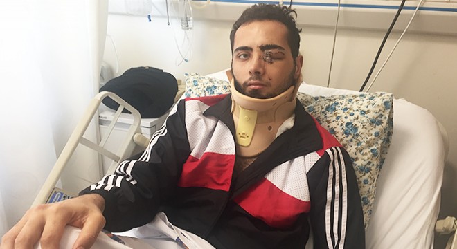 Yüzüne demir saplanan Emre, yoğun bakımdan çıktı