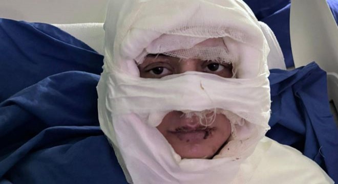 Yüzüne kolonya döküp ateşe verdiler