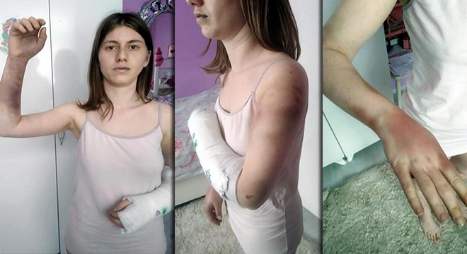 Zeynep'i beyzbol sopasıyla darbeden sevgilisine bir dava daha