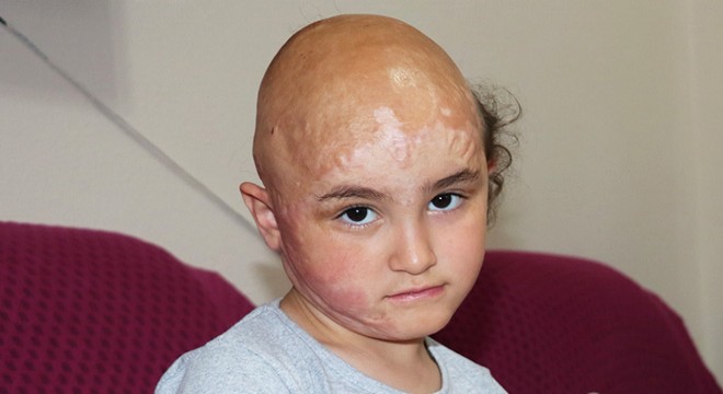 Zeynep'in 'peruk' hayali gerçek oluyor