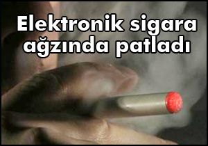 Elektronik sigara ağzında patladı