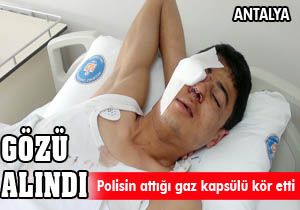 Polisin atığı gaz kapsülü kör etti