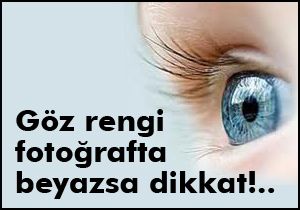 Çocuğunuzun göz rengi fotoğrafta beyazsa dikkat