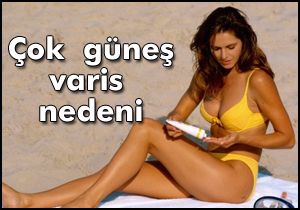 Çok güneş varis nedeni