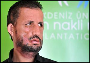Uğur Acar'ın jöle tutkusu