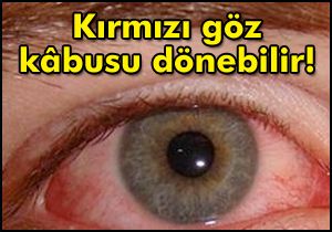 Kırmızı göz kâbusu dönebilir!