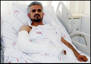 Basınçtan patlayan balatanın parçaları koluna saplandı
