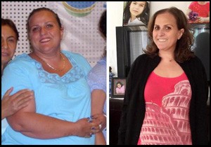 Ameliyatla 3 hastalıktan kurtuldu, 5 ayda 32 kilo verdi