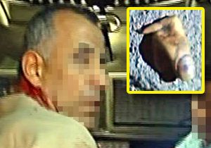 Bomba elinde patladı, polis anonsla yardım istedi