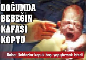 Doğumda bebeğin başı koptu