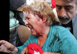 Cumhuriyet yürüşü mağduru o kadın hastanede