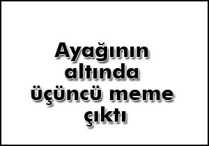 Ayağının altında üçüncü meme çıktı!..