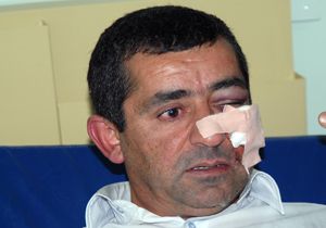 Öğrencisine'Kabadayılık yapma' dedi, babadan kafayı yedi
