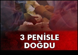 Üç penisle dünyaya gelen çocuk ameliyat edildi