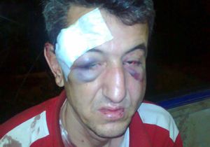Pompacı döven polise 7.5 ay hapis