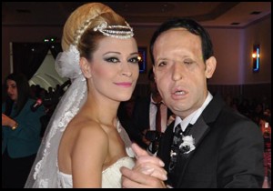 Yüz nakli olan Recep Sert, baba olmaya hazırlanıyor