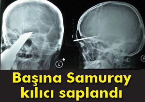 Başına samuray kılıcı saplandı