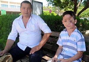 Sadık Efe'nin yanan yüzü yenilenecek
