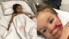 2 kardeşe felaketi yaşatan pitbullun sahibi tahliye edildi