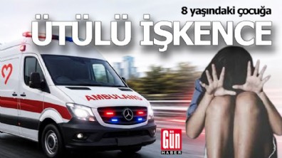 8 yaşındaki çocuğa üvey anneden ütülü işkence: 3 tutuklama