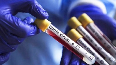 Kenya'da Ebola salgını nedeniyle bir kişi hayatını kaybetti