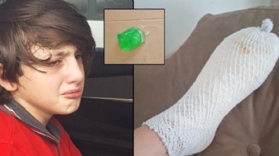 Oyuncak 11 yaşındaki çocuğun elinde patladı