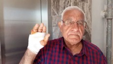 Akılalmaz olay: Komşusu parmağını ısırarak kopardı