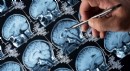 Alzheimer tedavisinde 'lityum' umudu