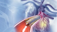 Anjiyo sırasında ölüm: 2 doktora hapis talebi